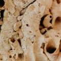 The Limitations of Current Research on D3 K2 and Osteoporosis