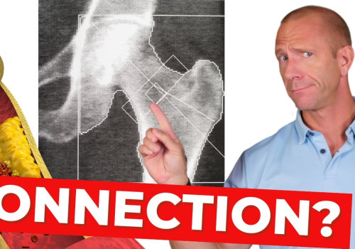 The Surprising Benefits of D3 K2 for Bone Health