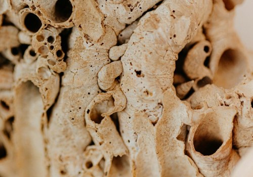 The Limitations of Current Research on D3 K2 and Osteoporosis